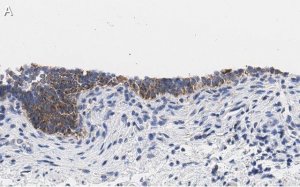 Anti-TMEM261 Antibody, clone 2C22 ZooMAb Rabbit Monoclonal 
