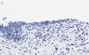 Anti-TMEM261 Antibody, clone 2C22 ZooMAb Rabbit Monoclonal 
