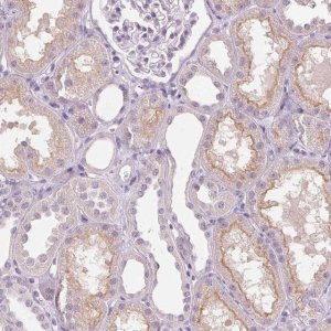 Anti-TMEM27 antibody produced in rabbit 