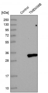 Anti-TMEM38B antibody produced in rabbit HPA018465-100UL