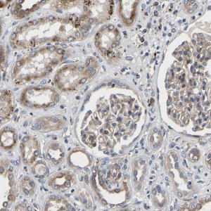 Anti-TMEM38B antibody produced in rabbit HPA018465-100UL