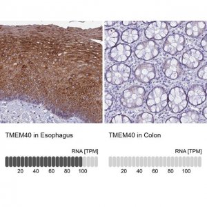 Anti-TMEM40 antibody produced in rabbit 