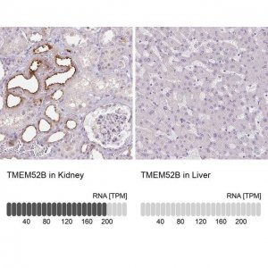 Anti-TMEM52B antibody produced in rabbit 