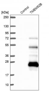 Anti-TMEM52B antibody produced in rabbit 