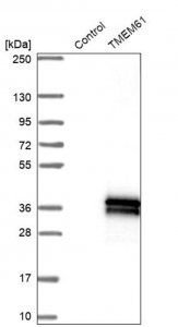 Anti-TMEM61 antibody produced in rabbit 