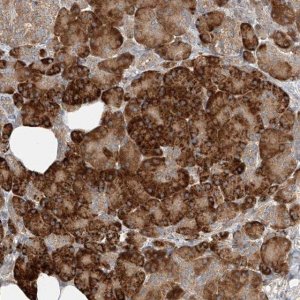 Anti-TMEM61 antibody produced in rabbit 