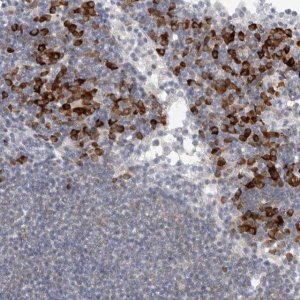 Anti-TMEM69 antibody produced in rabbit HPA026993-100UL