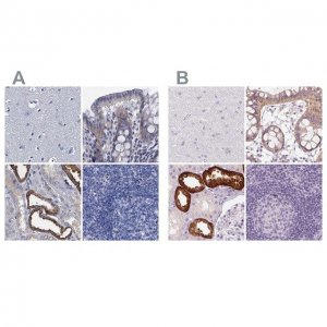 Anti-TMEM72 antibody produced in rabbit 