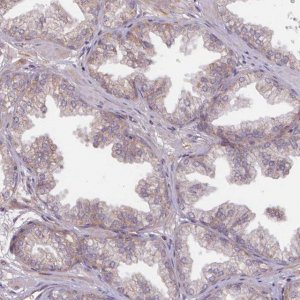 Anti-TMEM88 antibody produced in rabbit 