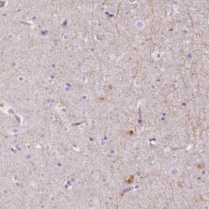 Anti-TMEM88B antibody produced in rabbit 
