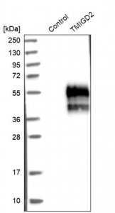 Anti-TMIGD2 antibody produced in rabbit 