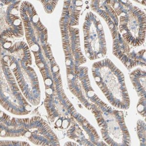 Anti-TMIGD2 antibody produced in rabbit 