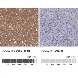 Anti-TMOD2 antibody produced in rabbit 