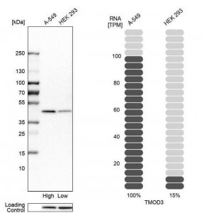 Anti-TMOD3 antibody produced in rabbit HPA001849-100UL