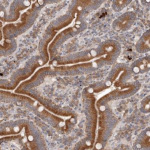 Anti-TMUB1 antibody produced in rabbit 