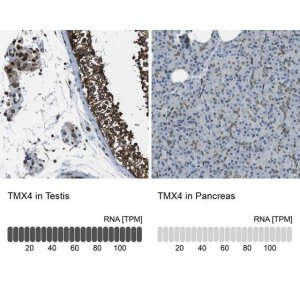 Anti-TMX4 antibody produced in rabbit HPA015752-100UL