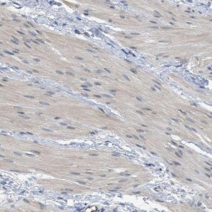 Anti-TNFAIP1 antibody produced in rabbit HPA014641-100UL