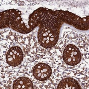 Anti-TNIP3 antibody produced in rabbit HPA043063-100UL