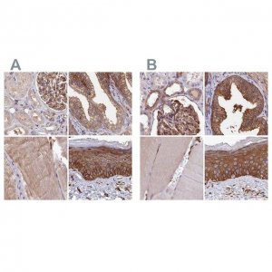 Anti-TNKS1BP1 antibody produced in rabbit 
