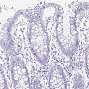 Anti-TNNT1 antibody produced in rabbit 