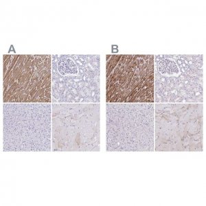 Anti-TNNT2 antibody produced in rabbit 
