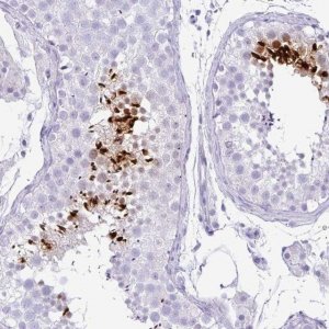 Anti-TNP1 antibody produced in rabbit 