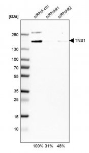Anti-TNS1 antibody produced in rabbit 
