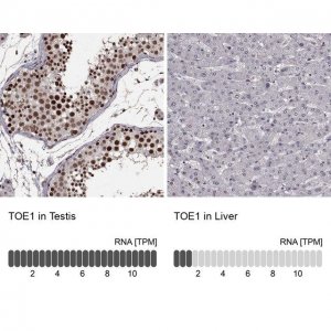 Anti-TOE1 antibody produced in rabbit HPA069119-100UL