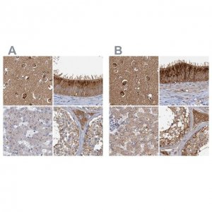 Anti-TOLLIP antibody produced in rabbit 