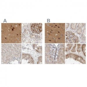 Anti-TOM1L2 antibody produced in rabbit 