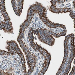 Anti-TOMM22 antibody produced in rabbit 