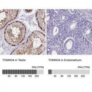 Anti-TOMM34 antibody produced in rabbit HPA056875-100UL