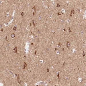 Anti-TOMM70 antibody produced in rabbit 