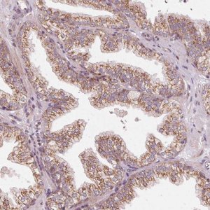 Anti-TOMM70 antibody produced in rabbit 
