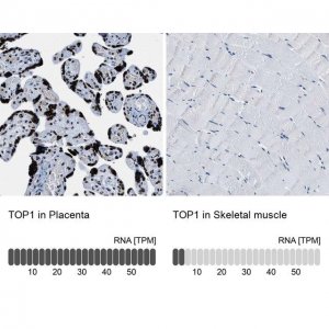 Anti-TOP1 antibody produced in rabbit 
