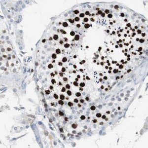 Anti-TOP2A antibody produced in rabbit 