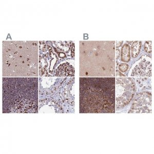 Anti-TOR1AIP1 antibody produced in rabbit 