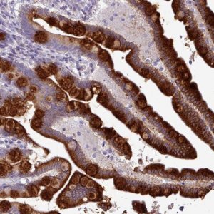 Anti-TOR1AIP2 antibody produced in rabbit 
