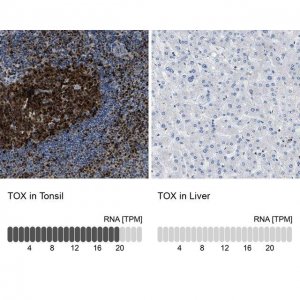 Anti-TOX antibody produced in rabbit 