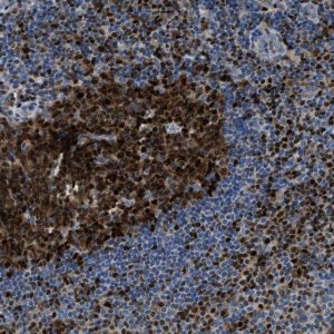 Anti-TOX antibody produced in rabbit 