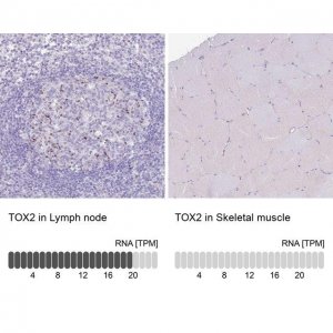 Anti-TOX2 antibody produced in rabbit 