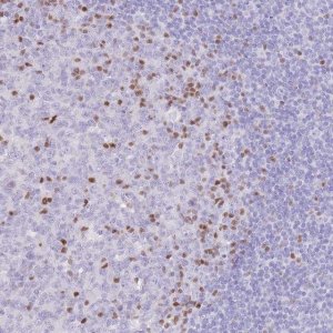 Anti-TOX2 antibody produced in rabbit 