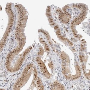Anti-TOX4 antibody produced in rabbit 