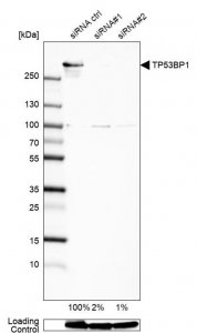Anti-TP53BP1 antibody produced in rabbit 