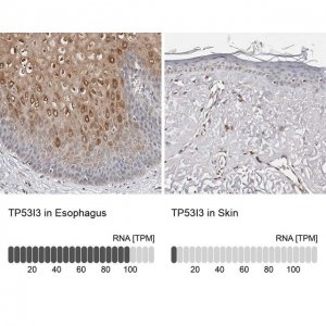 Anti-TP53I3 antibody produced in rabbit 
