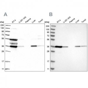 Anti-TP53I3 antibody produced in rabbit 