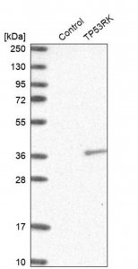 Anti-TP53RK antibody produced in rabbit HPA015837-100UL