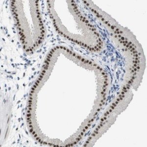 Anti-TP53RK antibody produced in rabbit HPA015837-100UL