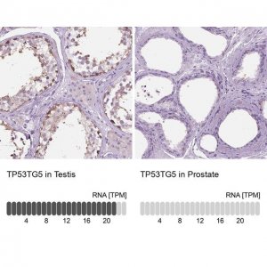 Anti-TP53TG5 antibody produced in rabbit 