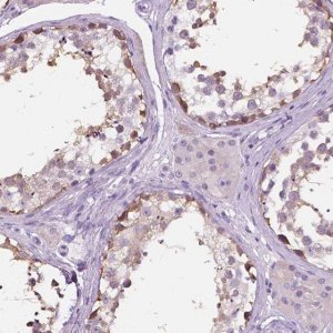 Anti-TP53TG5 antibody produced in rabbit 